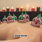 Who Can Benefit from cupping Therapy Near Me?