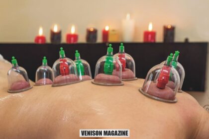 Who Can Benefit from cupping Therapy Near Me?