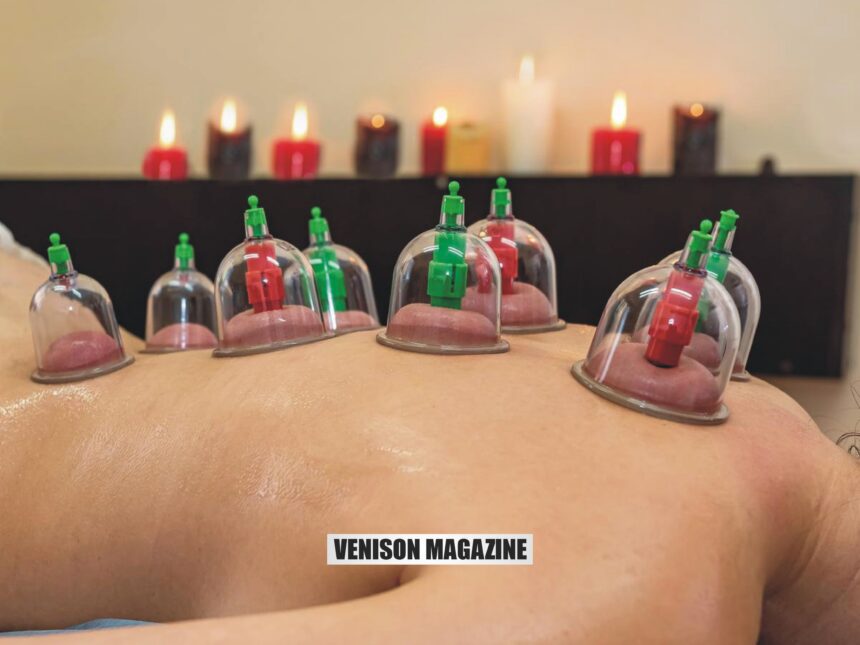 Who Can Benefit from cupping Therapy Near Me?