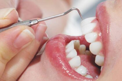 What Are the Best Services Teeth Cleaning Near Me?