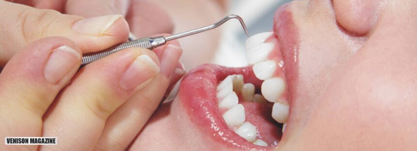 What Are the Best Services Teeth Cleaning Near Me?