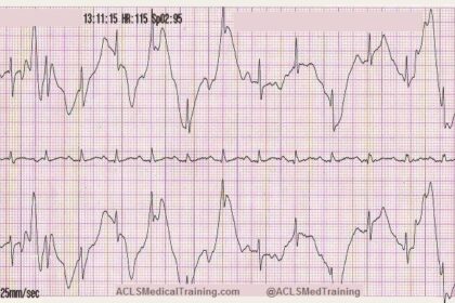 Artifact ECG: Unlocking the Secrets of the Universe