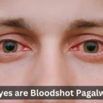 Its Eyes Are Bloodshot Pagalworld What's New