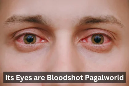 Its Eyes Are Bloodshot Pagalworld What's New