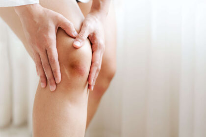  Qué Es Bueno Para Los Golpes? Tips and Remedies to Relieve Pain and Inflammation