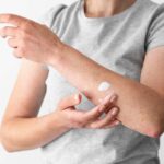 Hongos En La Piel Manchas: A Complete Guide to Understanding, Preventing, and Treating This Condition