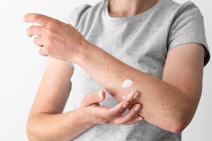 Hongos En La Piel Manchas: A Complete Guide to Understanding, Preventing, and Treating This Condition