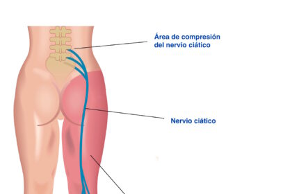 ¿Qué es un quiropráctico para qué sirve?