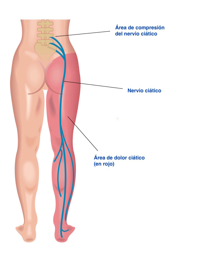 ¿Qué es un quiropráctico para qué sirve?