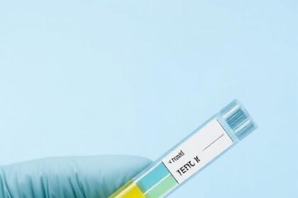 How to Store Test Cypionate: Explore It